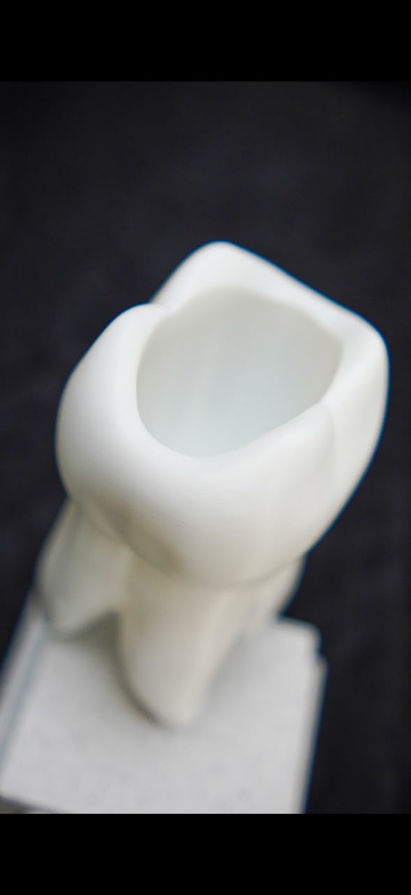 Tooth molar pen holder v2